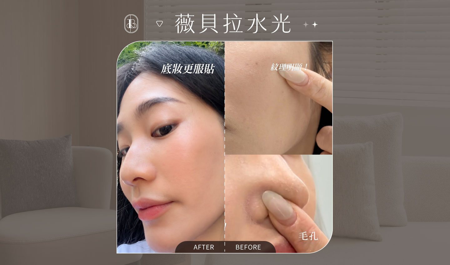 美力時尚診所薇貝拉水光針案例：KOL陶薇薇BA