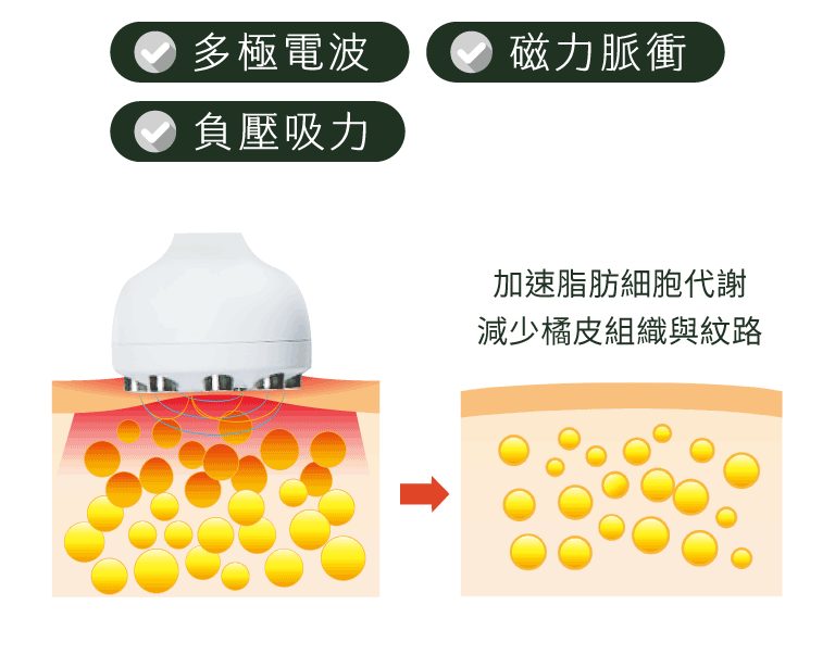 必麗塑_MP雕塑探頭