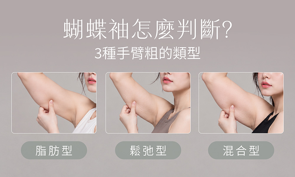 蝴蝶袖怎麼判斷