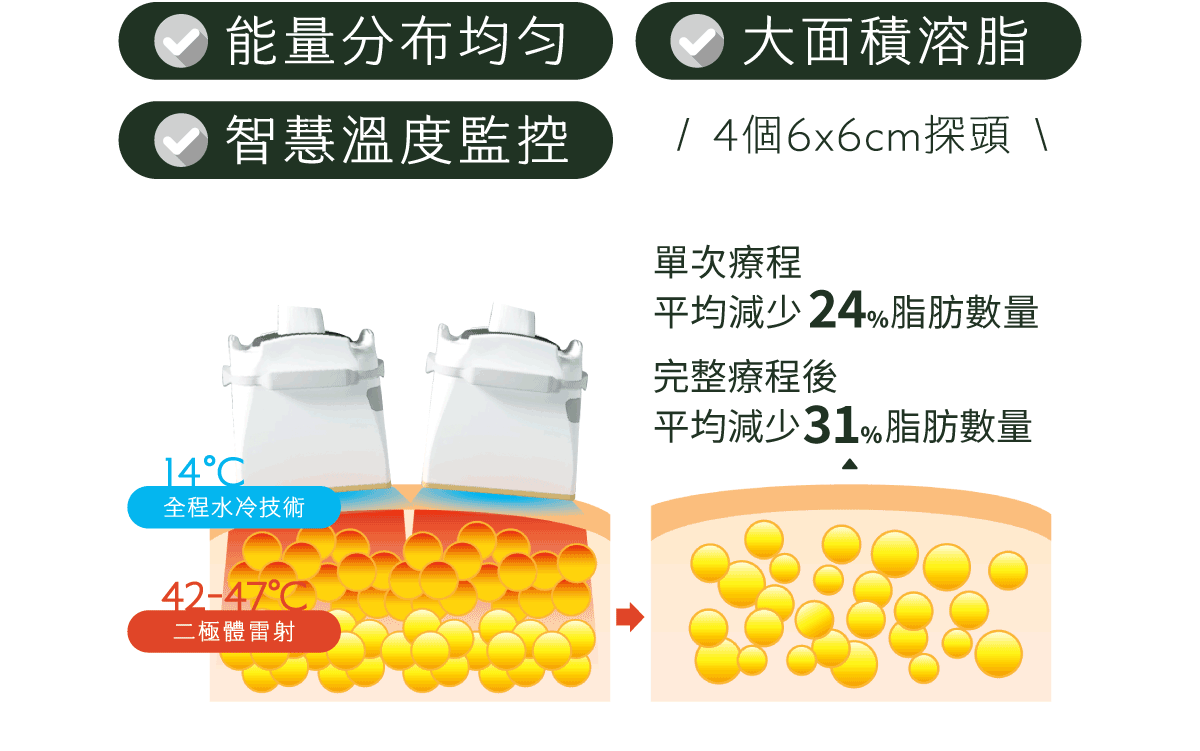 必麗塑雷射探頭