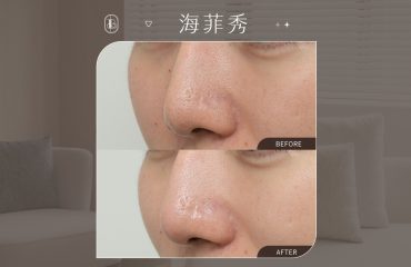 Dcard_孫元山won_海菲秀