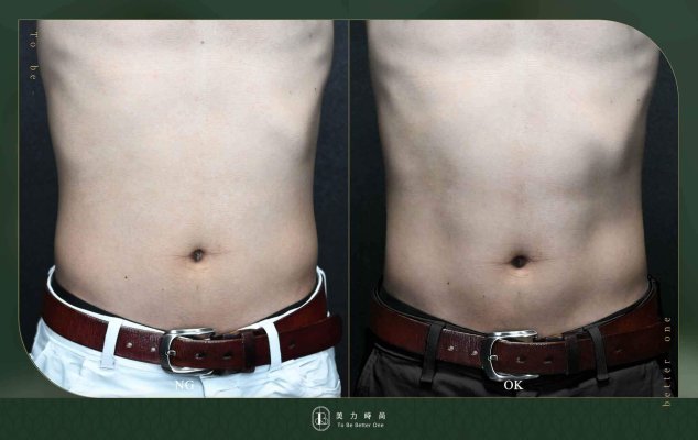 EMBODY療程BA照-腹肌男