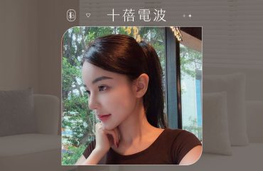 美力時尚診所案例：十蓓電波BA_臉部緊緻、下顎線完美