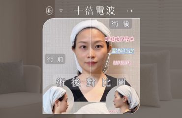 十蓓電波KOL體驗分享BA