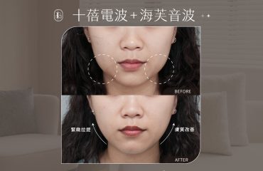 十蓓電＋海音三-claire-BA