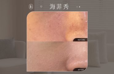 網紅《勳狗》海菲秀體驗心得分享