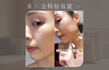 立特拉音波-KOL楊晴